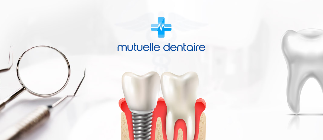 découvrez notre mutuelle dentaire sans plafond, qui vous offre une couverture complète et sans limites pour vos soins dentaires. profitez d'un remboursement optimal pour tous vos traitements, que ce soit pour des soins préventifs ou des actes plus poussés, tout en maîtrisant votre budget santé.